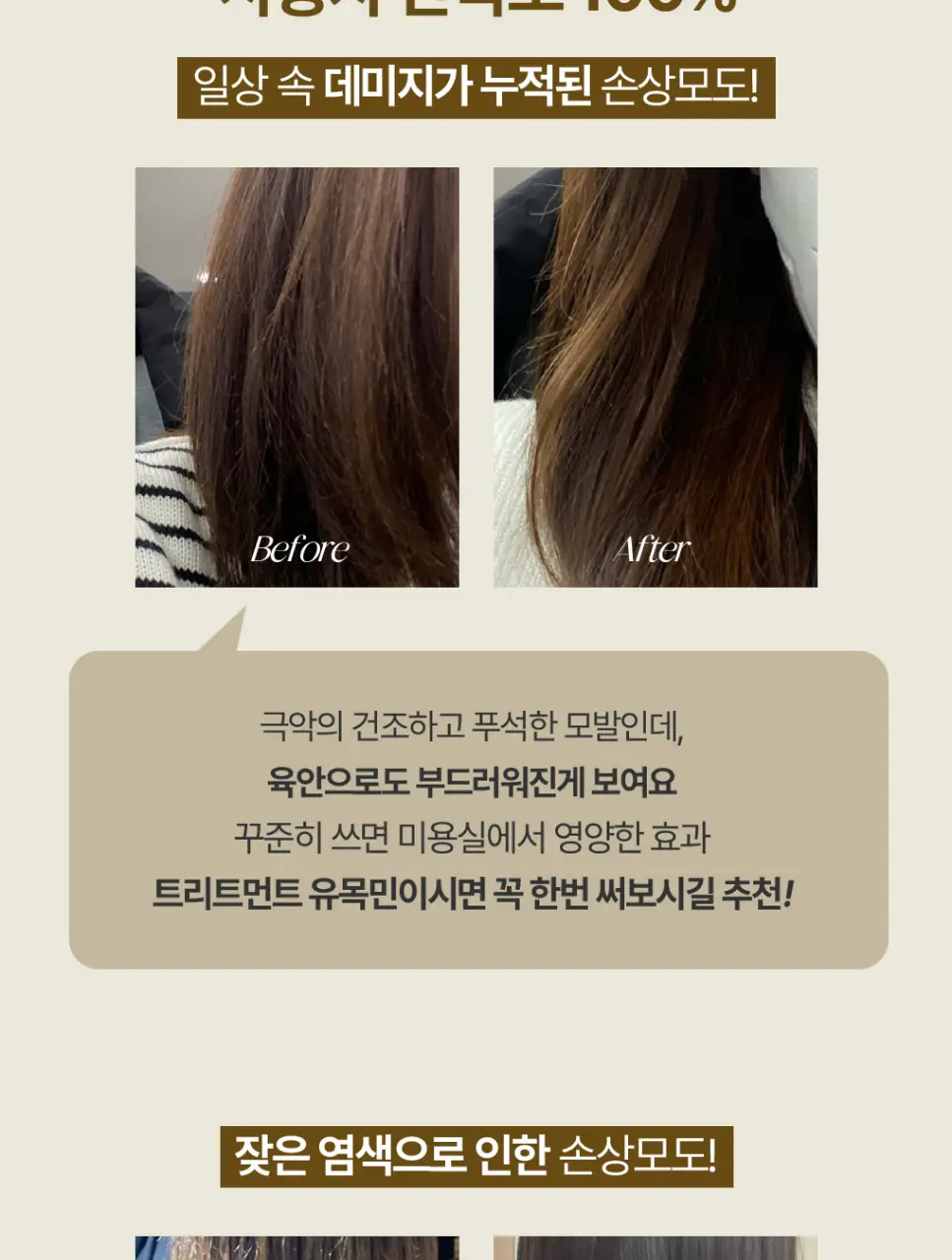 [1&1기획/백호PICK]트리셀 포르테 앰플 트리트먼트 기획세트 (200ml+200ml) 상세페이지 10